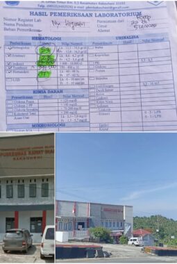 Bidan berinisial A di puskes Bakauheni kabupaten Lampung Selatan diduga melakukan malpraktik